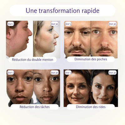 Appareil de Beauté Visage &amp; Cou – Raffermissant, Anti-Rides &amp; Réducteur de Double Menton