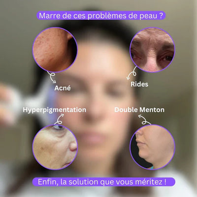 Appareil de Beauté Visage &amp; Cou – Raffermissant, Anti-Rides &amp; Réducteur de Double Menton