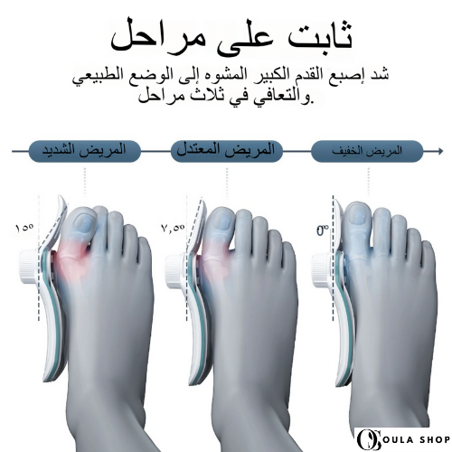 مصحح الورم القابل للتعديل بتقنية المقبض الدوار